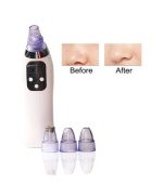 Aspirateur de nettoyage du visage WeiMingZhu – Image 3