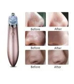 Beauty Skin Care Specialist Aspirateur De Point Noir Nettoyeur du visage – Image 2