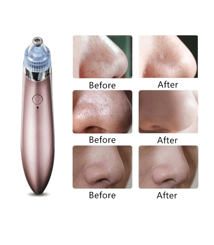 Beauty Skin Care Specialist Aspirateur De Point Noir Nettoyeur du visage – Image 2
