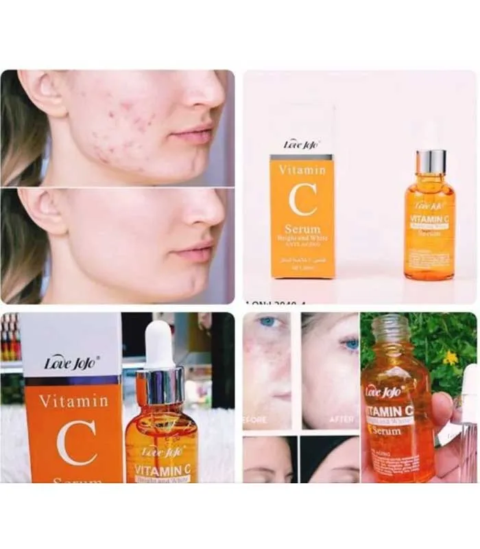 Sérum Vitamine C Love JoJo 30ml – Image 2