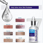 Sérum anti-acné BIOAQUA 30ml